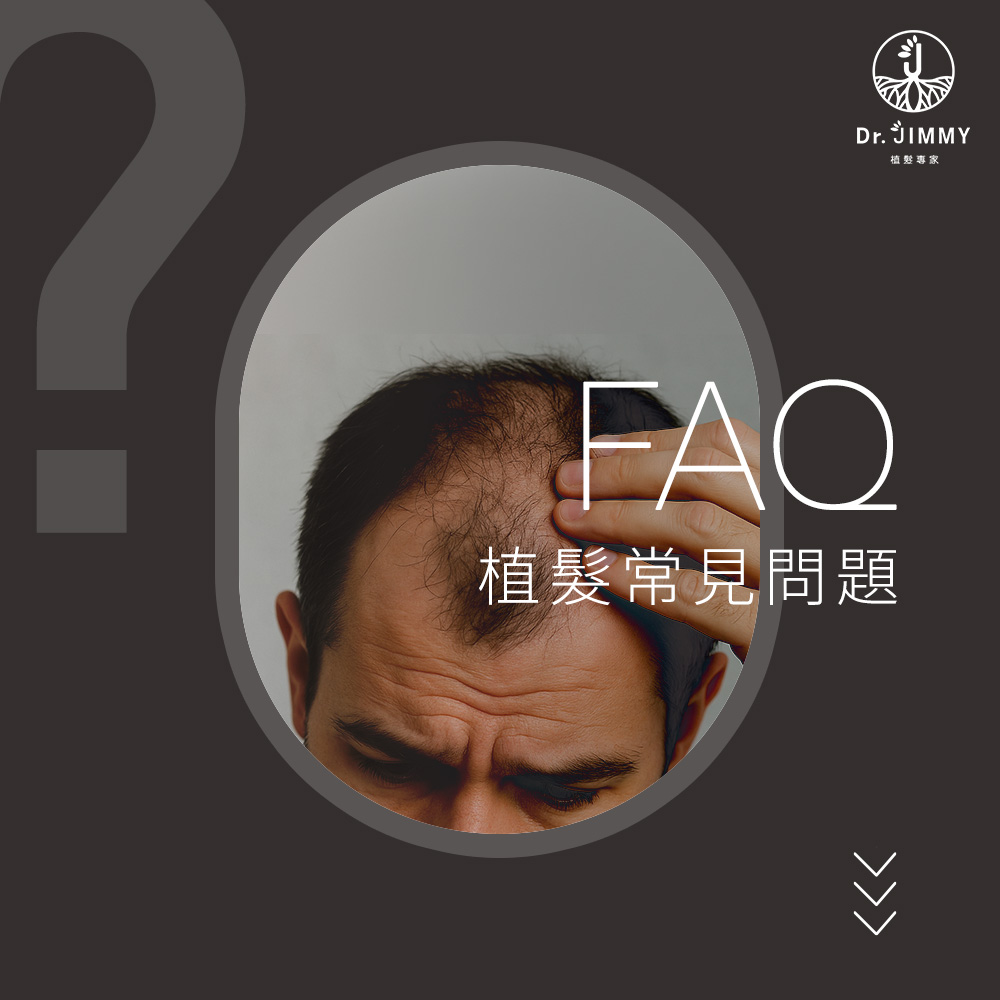 髮際線植髮推薦，植髮權威 沈彥廷