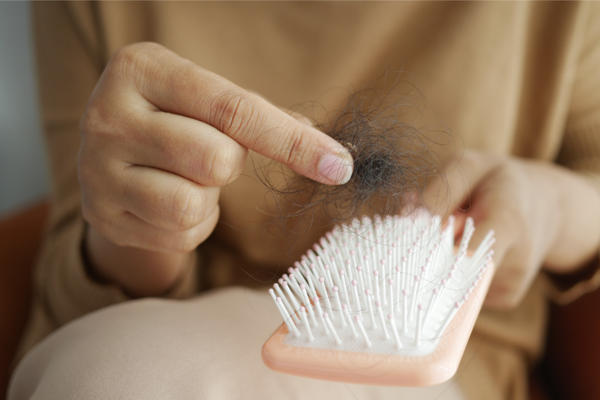 女生植髮常見問題全解析：M型禿、髮量稀疏、成功案例大公開