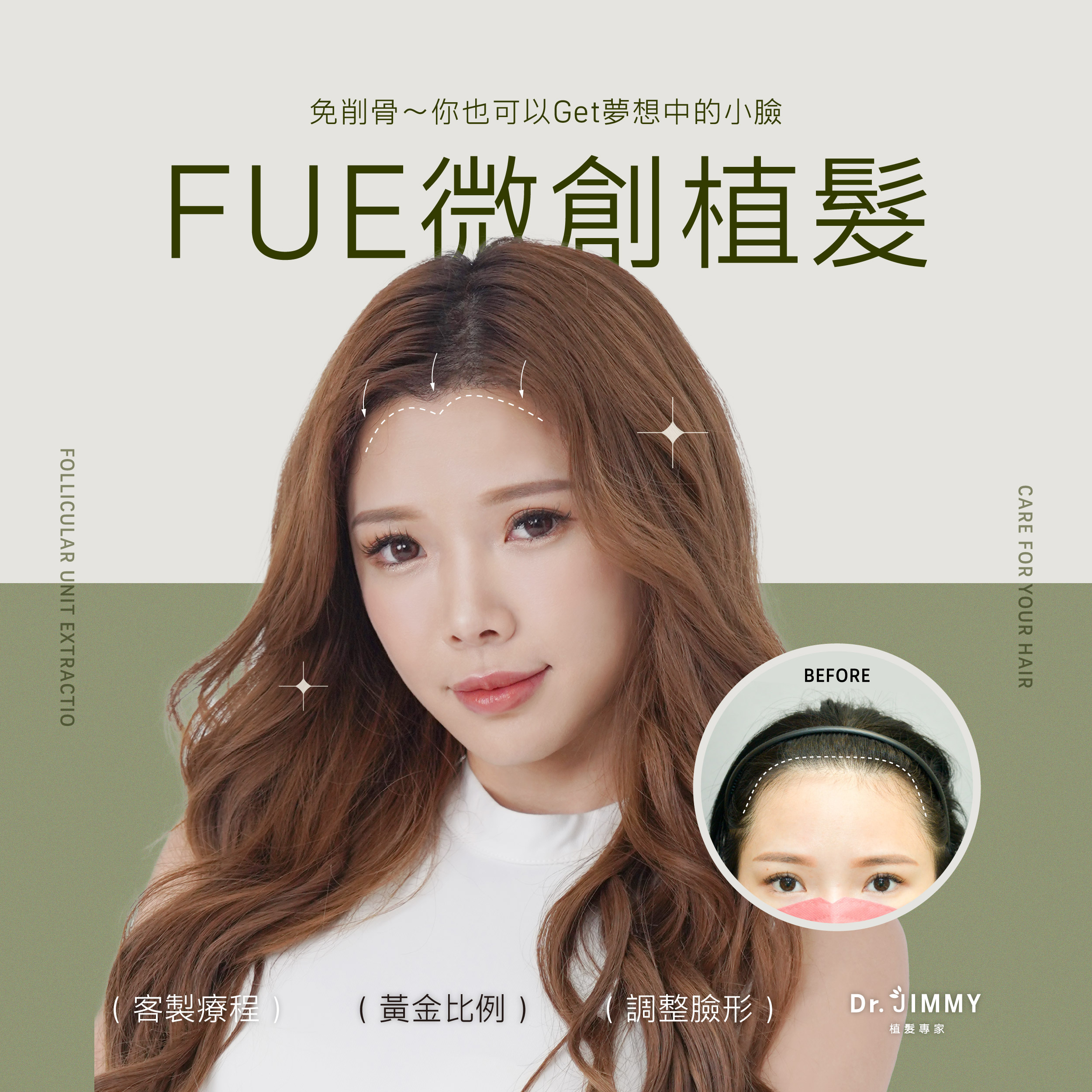 手術或療程皆具醫療風險，請依專業醫師評估自身狀況再進行治療。本案例圖文為親身體驗分享，已獲得當事人同意，僅供參考。