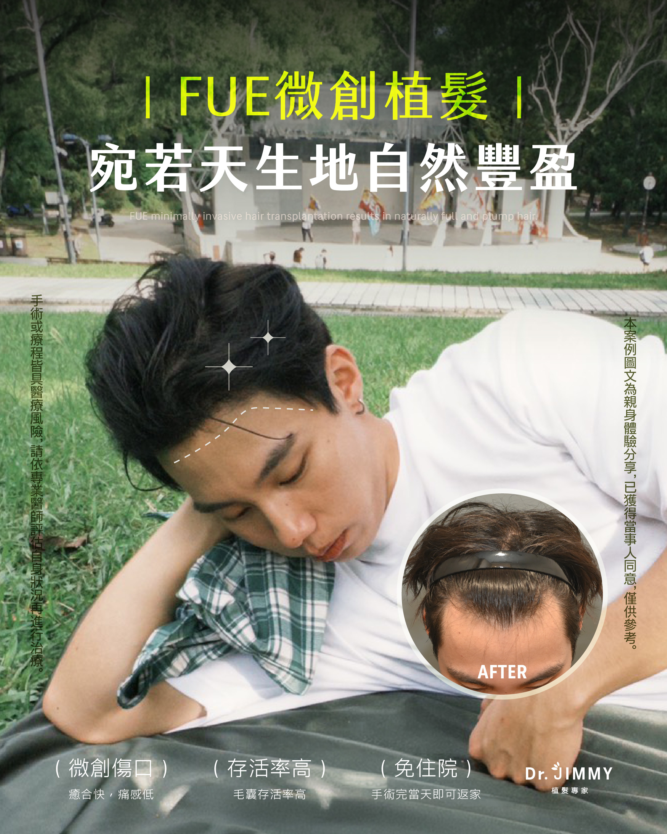 台南植髮該怎麼選?植髮費用多少?M字禿、高額頭、頭頂稀疏適合植髮嗎?本文由專業植髮醫師角度解析台南FUE植髮流程、術後恢復期、常見問題與注意事項,幫助您找到適合自己的植髮方案。