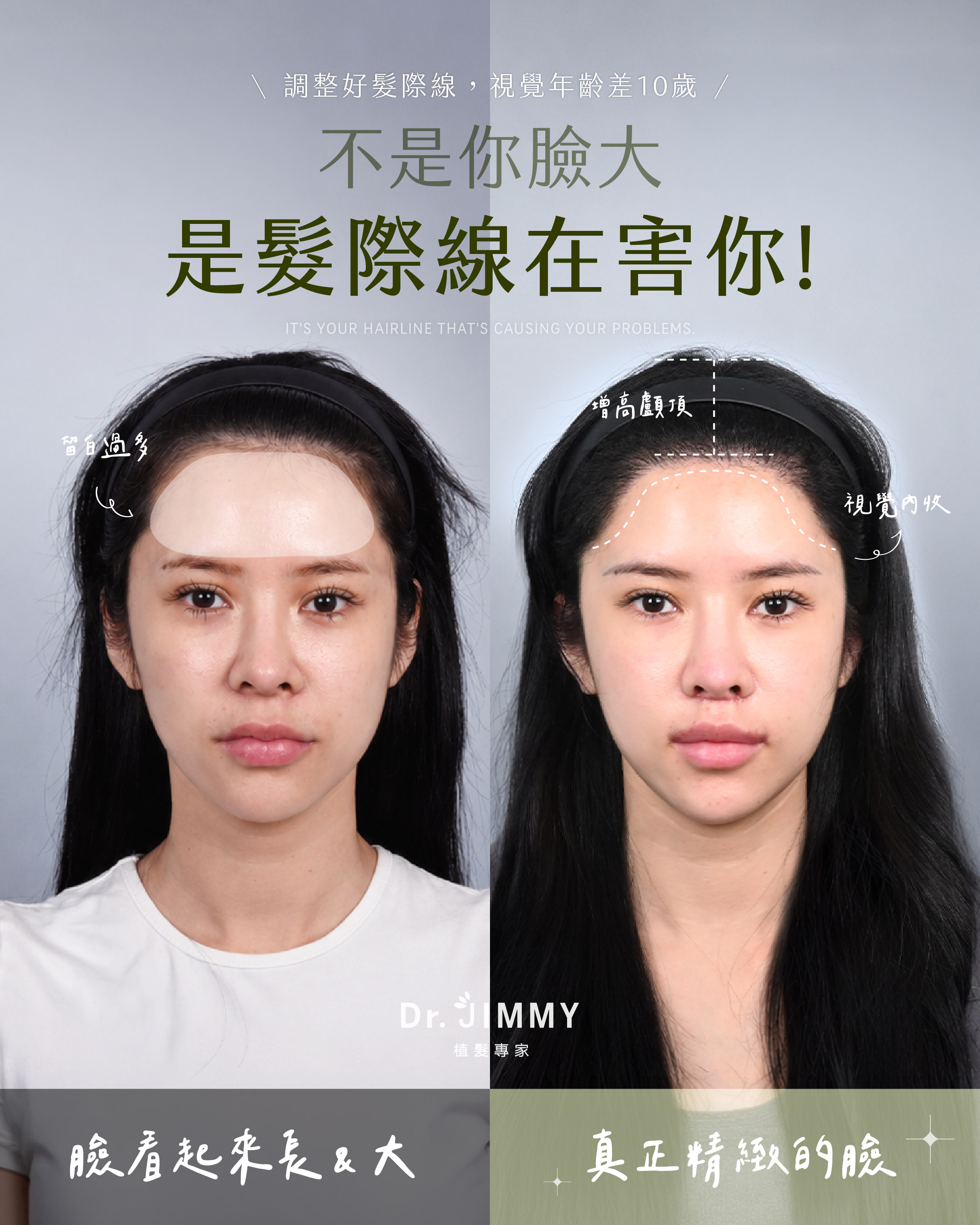 植髮失敗還能補救嗎?哪些情況有救、哪些沒有?