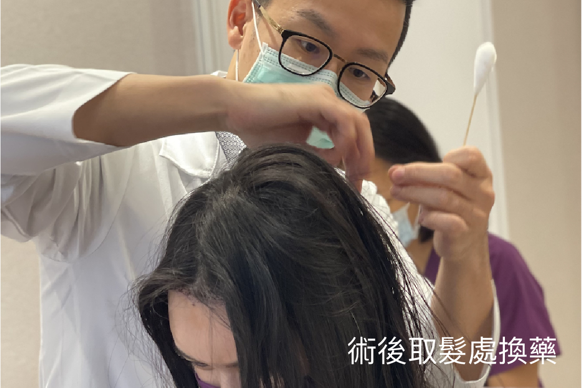 植髮會被同事發現嗎？上班族必看：真實恢復時間線與「不顯眼植髮」全攻略