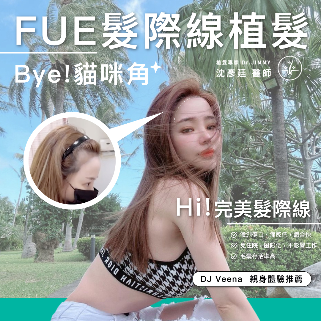 植髮會被同事發現嗎？上班族必看：真實恢復時間線與「不顯眼植髮」全攻略