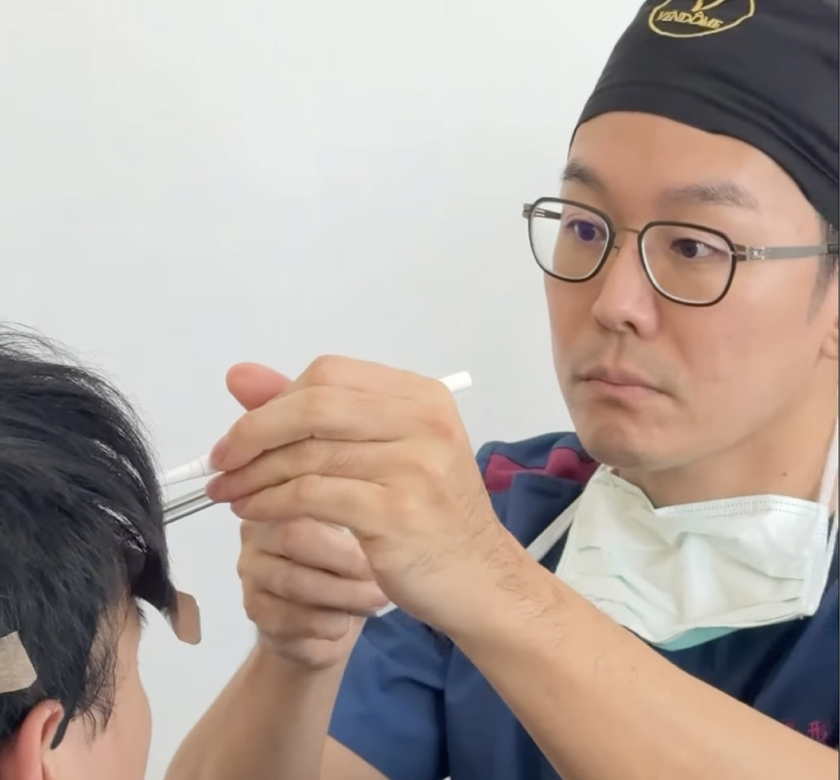 植髮前一定要認識的醫師：沈彥廷醫師的專業與堅持