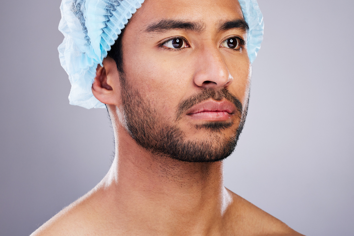 鬍鬚與鬢角植髮指南：造型設計、手術流程、恢復期與費用